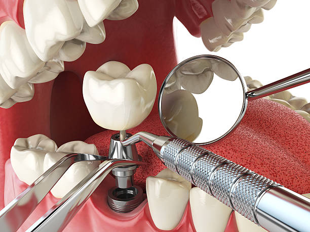 Best Emergency Dentist for Special Needs Patients in Marshfield, MO