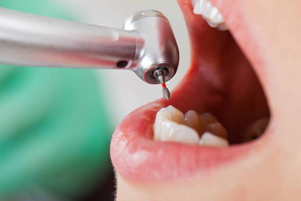 Best Emergency Cosmetic Dentistry in Marshfield, MO